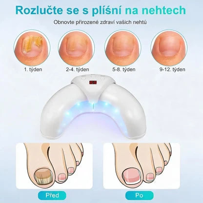 Trojitá Lampa pro Péči o Nehty – 7 Minut Denně pro Čistší a Zdravější Vzhled Nehtů